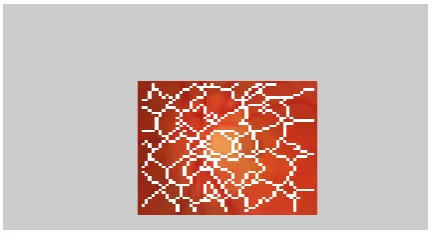 Figure 2- Superpixel Generation of the preprocessed image 