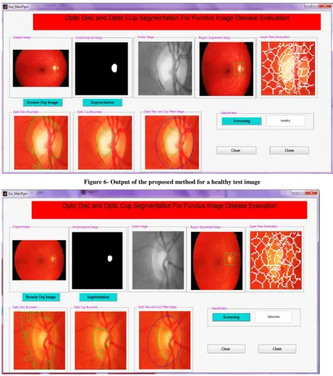 Figure 6- Output of the proposed method for a healthy test image 