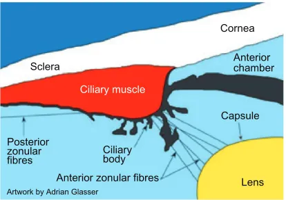 Figure 1 schematic diagram showing anatomy of accommodation (Glasser2000). Glasser shows the pars plana zonule but does not show vitreous zonule.Note:restoration of accommodation: surgical options for correction of presbyopia