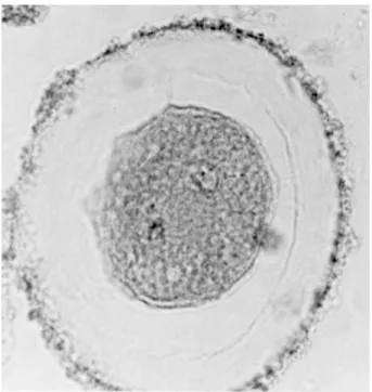 Figure  5.  Picture  of  the  Same  Ascaris  Cell  of  Approximately  Equal  Magnification as in Figure 4, Obtained with LHM