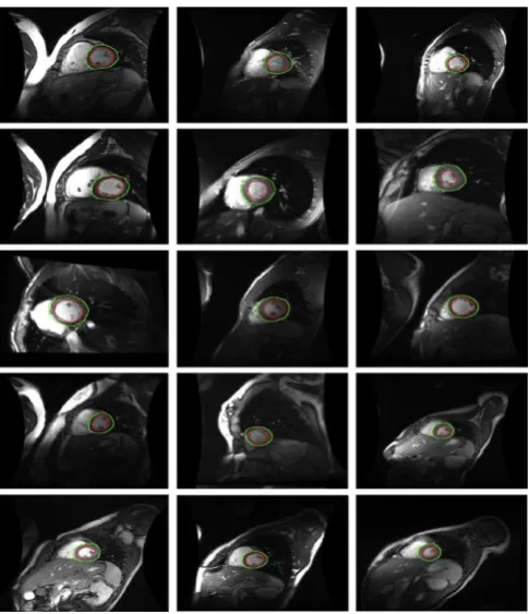 Figure 5.4: Matching data set 13 with slice-wise texture visualization. The top row shows three slices of data with the initial model superimposed