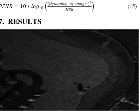 Fig 5: Forward CDF 5/3 DWT using Lifting Scheme 