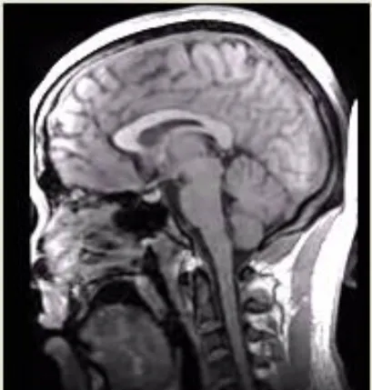 Figure. 1: X-ray of Hand and Pelvic of Human [68] 
