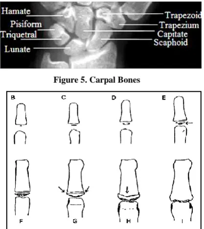 Figure 5. Carpal Bones 