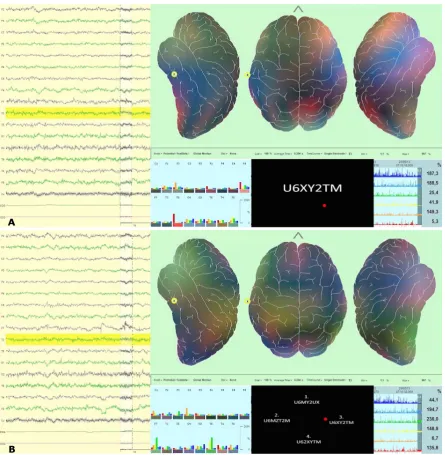 Figure 10. (A) and (B) The red spot in the gaze overlay video (between bar graph and time line in the lower middle part of the image) represents the momentary gaze of the subject