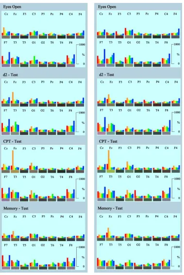 Figure 4. Time averaged quantitative documentation of spectral frequencies during relaxation and per-formance of three psychometric tests (d2-test, CPT and Memory-Test)