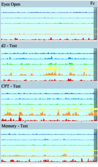 Figure 5. Time lines for the electrode position Fz with a resolution of 728 ms per epoch (single needles)