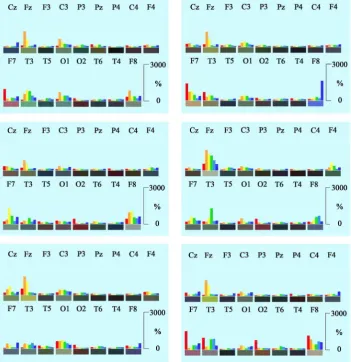 Figure 8. Collection of regional distributions of spectral frequencies during performance of the calculation performance test (CPT) based on single epochs of 728 ms duration