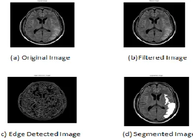 Fig 2. Samples of brain MR image 