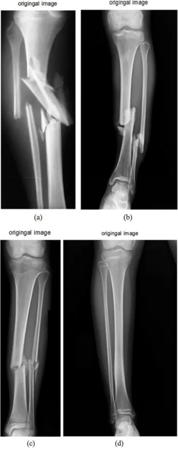 Figure 6. Original Input X-ray Images.  3.2. Preprocessing 