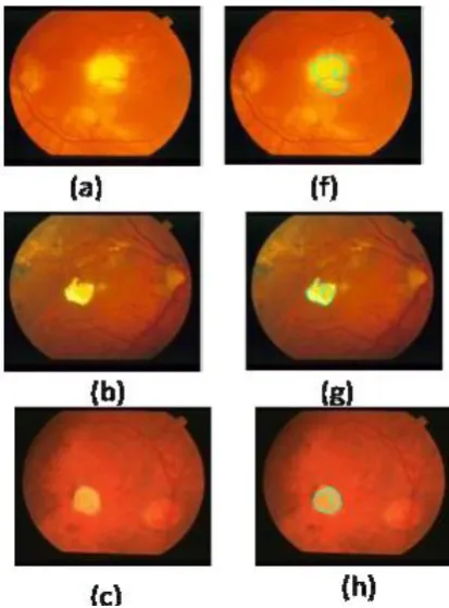 Fig 2 (a)Original Image (b)Grayscale Image (c)Prewitt (d)Sobel (e)Roberts (f)LOG (g)Canny 