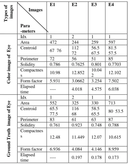 Table 2. Comparison between original & raw images of brain tumor  with parameters. 