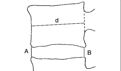 Fig. 2 Disc height index according to Dabbs’ method. The average intervertebral disc height (A+B/2) was normalized with the anteroposteriordiameter (d) of the upper vertebral body to correct for the magnification differences of the radiographs