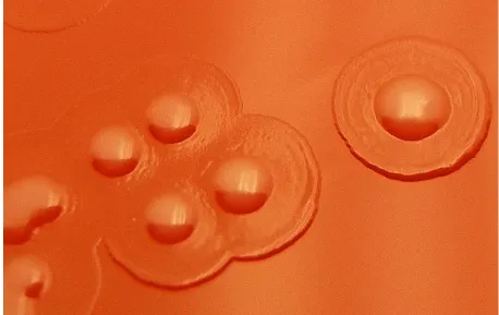 Figure 2. Fried egg appearance of Moraxella growing on trypticase soy agar supplemented 