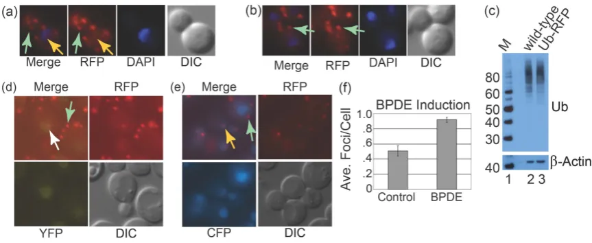 Figure 1. (a) Merged RFP and DAPI fluorescent images are shown (left) of a Ub-RFP cell 15 min following induction with UV-C (20 J/m2) followed by images containing only RFP and DAPI channels (middle) and a differential interference con-trast (DIC) image (r