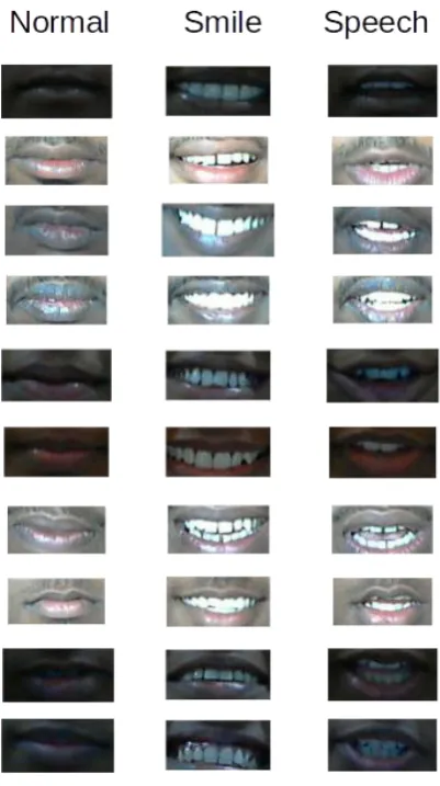 Fig. 5: Samples of excerpted mouth area 