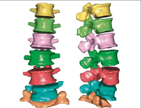 Fig 1 The solid model of spinal column including T12-S1 with the character of coronal Cobb angle about 10° and L4 spondylolisthesis andvertebra osteophyte