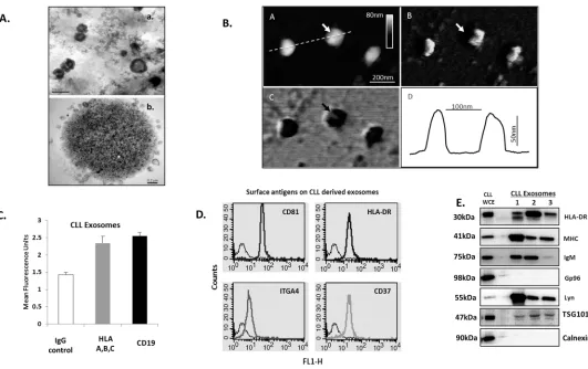 Fig 1. Characterization of CLL derived exosomes. A) Transmission electron microscopy (TEM) image of exosomes enriched from CLL cell culturemedium after 48 hrs