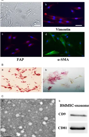Figure 1. Isolation and identification of MSCs and MSC-exosomes. A. Human BM-MSCs (a) were spindle-shaped and plastic adherent when maintained in Dulbecco’s modified Eagle’s medium with low glucose supplemented with 15% fetal bovine serum (magnification 20