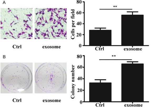 Figure 2. MSC-exosome promoted lung tumor migration and growth. A. Rep-resentative images showing that MSC-exosomes improved A549 cell pen-etration through membrane (magnification 200 ×; scale bar = 50 μm); B