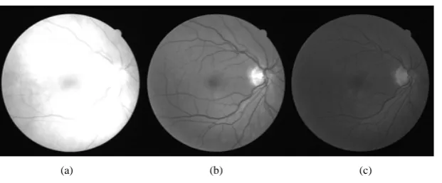 Figure 1. Extraction of RGB Image: (a) Red channel component; (b) Green channel component; (c) Blue channel component