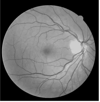 Figure 2. Non illuminated image processed as an equaly distributed illumi-nated image: (a) Original image; (b) After adjusting the illumination variaton