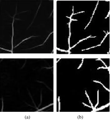 Figure 4. Image window binarization (a) Ga-bor filter response; (b) Binarized response
