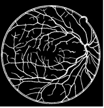 Figure 5. Apply 2-D Gabor filter (a) Inverted input image; (b) Gabor response image.             