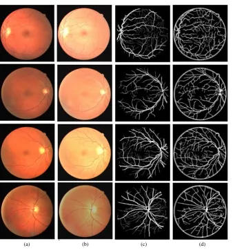 Figure 7. Retinal vessel segmentationprocess and results (a) Images from DRIVE dataset; (b) Images with adjusted illumination variation; (c) Manual segmentation; (d) Proposed method results