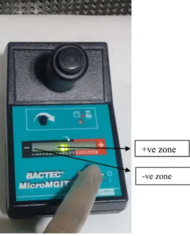Figure 1. Micro mgit positive and negative zone.     
