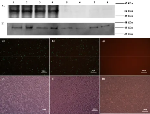 Figure 2. In vitro expression of N protein. A, B) WB. A) Positive band of 52 kDa detected in lane 1 (CCHFV Ank-2 infected SW-13 cells), lane 2 (BoHV4-∆TK-CCHFV-N infected MDBK cells), lane 3 (Ad5-N infected HEK293A cells), and lane 4 (pCD-N1 transfected HE