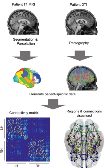Fig 6. The creation of a connectome. A diagrammatic representation of the connectome creation process,combining information from T1 MRI and DTI to create a network formed from brain regions connected bywhite matter fibres