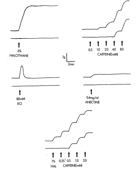 Figure 3.1 Contracture responses used for MH diagnosis 