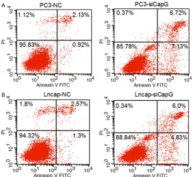 Figure 2. CapG expression was measured in human prostate cancer cell lines. A: CapG expression was measured in PC3, Du145 and Lncap cell lines by qRT-PCR and Western blot