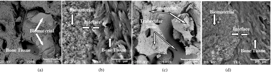 Figure 6. (a) HA biopsy, 60 days, osseointegration; (b) Quality of biomaterial/bone tissue interface; (c) HA biopsy, 90 days, well formed bone tissue; (d) Quality of biomaterial/bone tissue interface