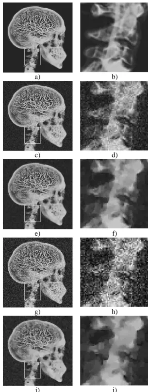 Figure 1: Denoising of the artificial image: a)-b)  original image, c)-d) noisy image with linear  combi-nation of noises, e)-f) denoised image (c), g)-h) noisy  image with superposition of noises, i)-j) denoised  image (g)