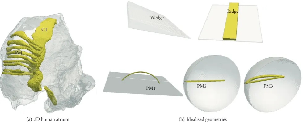 Figure 2: 3D human atrium anatomical model and idealised geometries. In all geometries, the atrial wall is shown as translucent gray whilethe endocardial structures and their idealizations are shown as solid (yellow online)