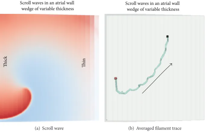 Figure 5: Cross-sectional endocardial views of the atrial geometry. (a) Overall anatomical structures considered in this study that give varyingwall thickness, ridges, or bridge formations