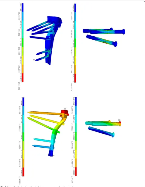 Fig. 2 Stress distribution (upper) and displacement pattern (lower) on implants