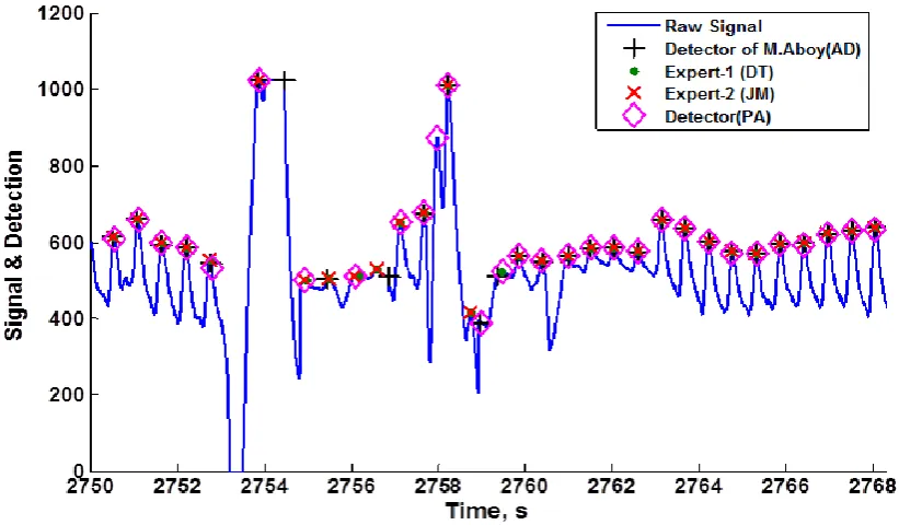 Fig  5: Example showing a PPG signal of the validation data set and the systolic peak identified b the detection algorithm of  M Aboy et al , two experts and the detection algorithm