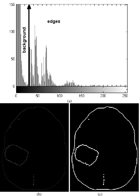 Figure 7. Mean Shift Gradient thresholding of a brain tumor image, without filtering step