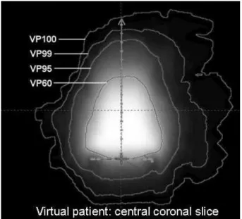 Figure 5: Illustration of the cervix cancer spatial distribution representing a virtual patient, the central coronal slice.