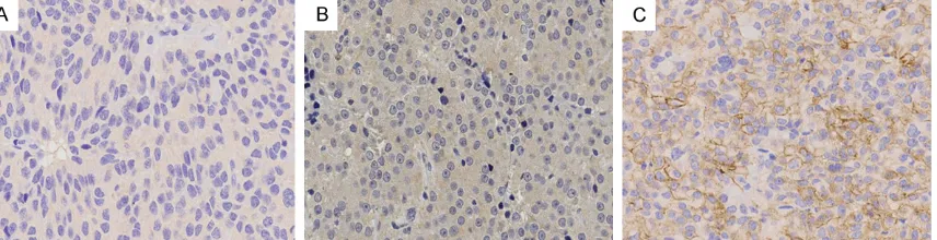 Figure 3. Heterogeneous immunohistochemical expression of SSTR5 in TSHoma. Representative examples of SSTR5 expression