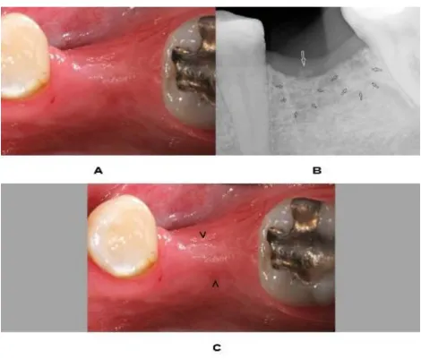 Figure 2:  2 Years 