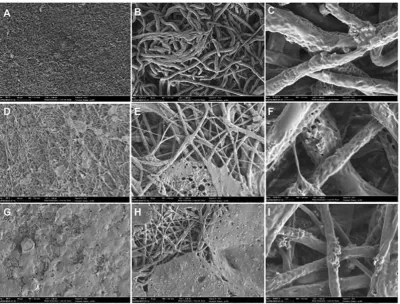 Figure 2 - Scanning electronmicroscopy (SEM) micrographs of the membrane 