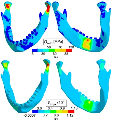 Figure 4. Maps of (a) maximal principal stress and (b) maximal principal strain in the case of blow to canine region (CI)
