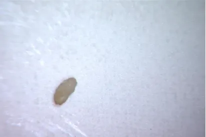 Fig. 1 Showing 0.1 mg of pulp tissue 