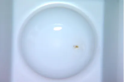 Fig. 4 Showing 0.1mg of pulp tissue during dissolution 