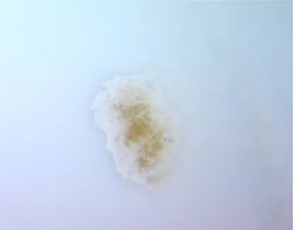 Fig. 5  Showing the dissolution of the pulp tissue 