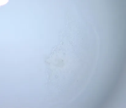 Fig. 7 Showing complete dissolution of the pulp tissue 
